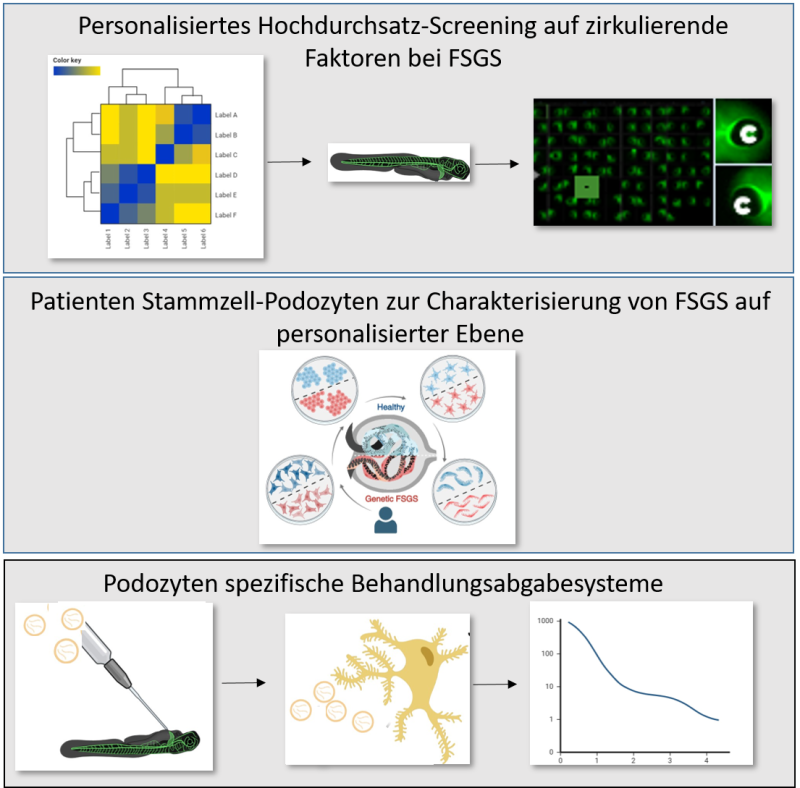 Graphical Abstract Entschlüsselung der humanen FSGS auf Einzelzellebene